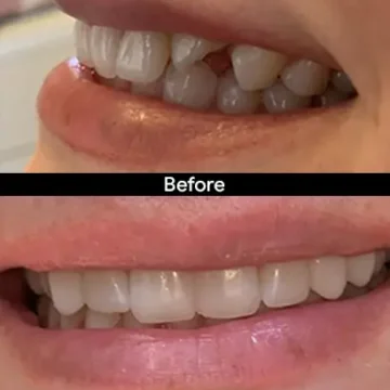 Smile transformation