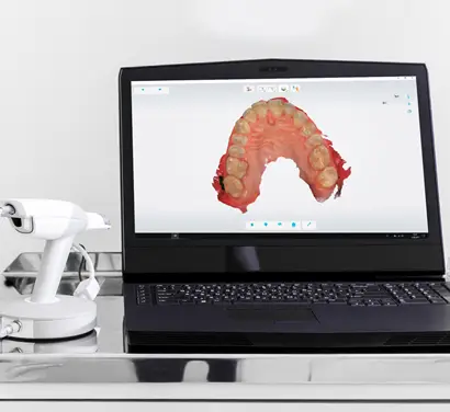 Intraoral Scanner